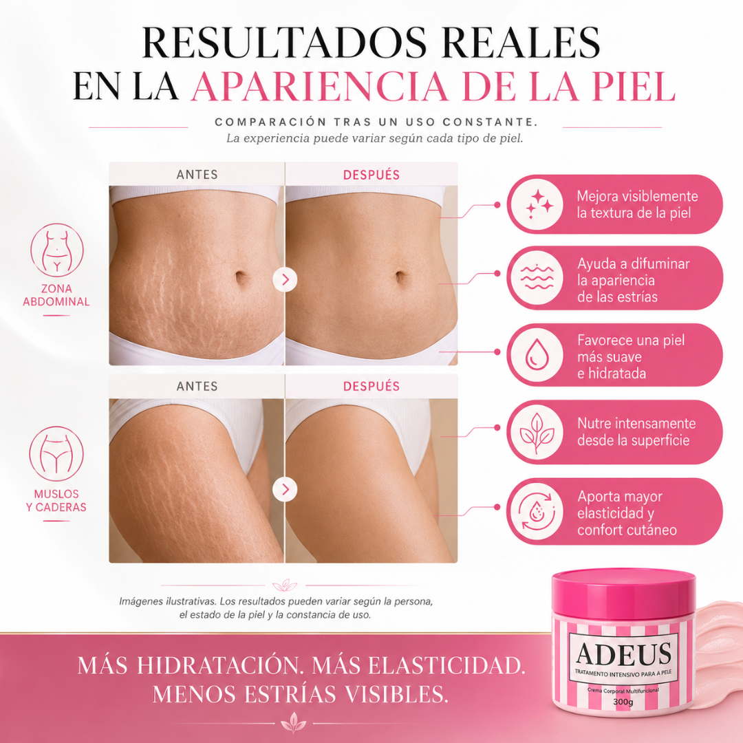 Crema Adeus - Ayuda a Suavizar Tus Estrías