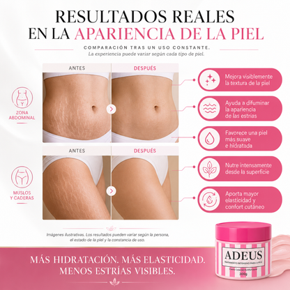 Crema Adeus - Ayuda a Suavizar Tus Estrías